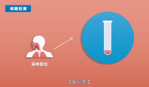 核酸检测的咽拭子阳性和胶体金检测阳性哪个准确？